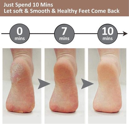 Rechargeable Electric Foot Callus Remover
