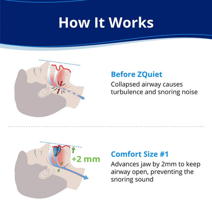 Anti-Snoring Mouthpiece-2 Pcs